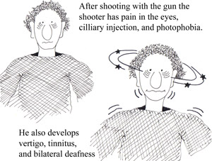 Topical steroids systemic side effects